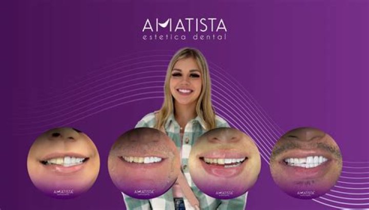 Amatista Estetica Dental Veneer / Cancun Vlog YouTube
