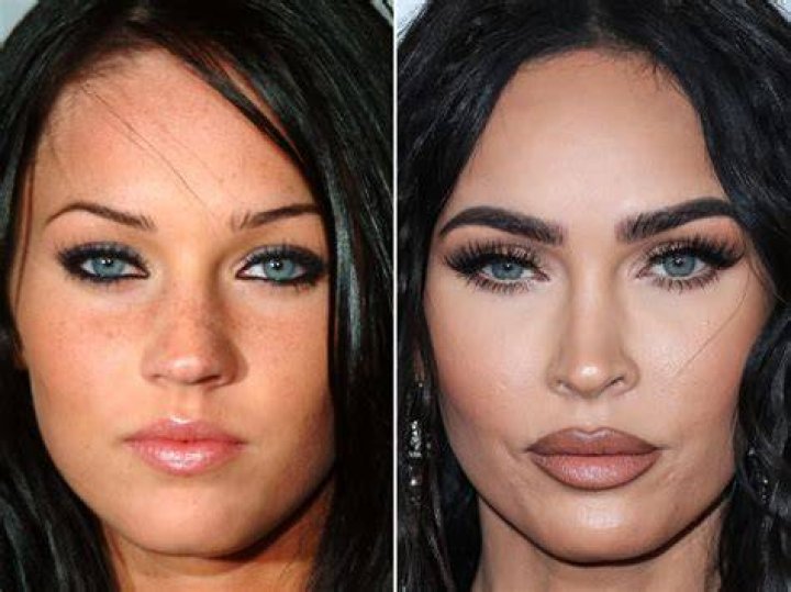Before And After Surgery Revelations