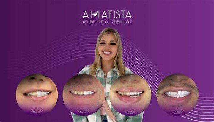 Inicio Amatista Estetica Dental