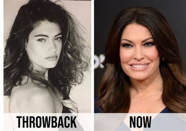 Kimberly Guilfoyle Before Surgery, Young Photos Age And Husband Revealed