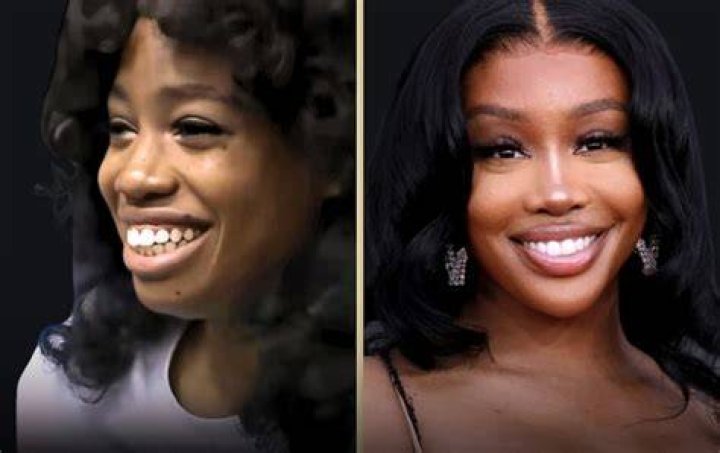 SZA Before Surgery: How the Singer Transformed Her Looks and Voice