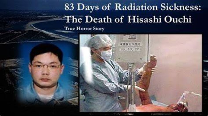 Unveiling The Devastating Truths Behind "Hisashi Ouchi Pictures In Hospital"