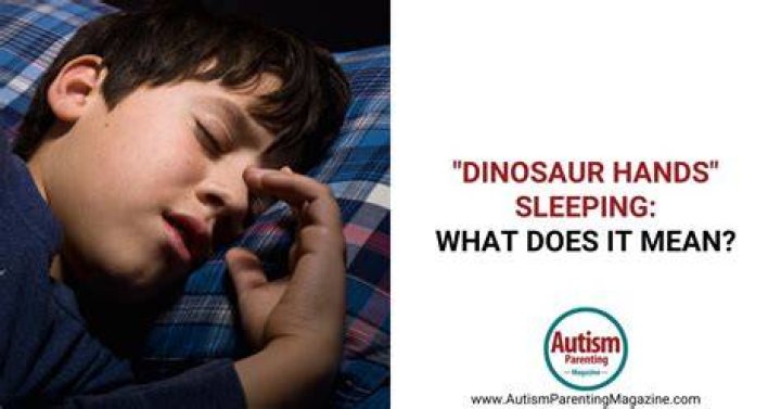 Unveiling The Secrets Of "Sleeping With Dinosaur Hands" ADHD